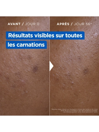 Mixa Niacinamide Bright Cream - Face, Body, Hands