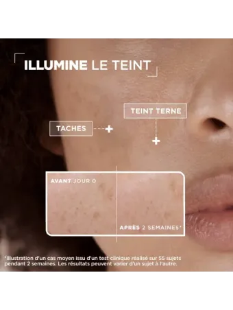 Sérum Concentré Anti-taches
