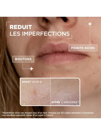 Sérum Concentré Anti-imperfections
