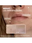 Sérum Concentré Anti-imperfections Sérum Concentré Anti-imperfections