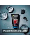 Nettoyant 3 en 1 Charbon Anti-Points Noirs