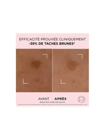 Age Perfect Golden Age​ Sérum Correcteur Taches Brunes