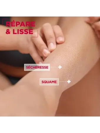 Mixa Urea Cica Repair+ Body Milk
