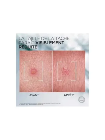 Men Expert Derma Control S.O.S Pimple Patch Niacinamide
